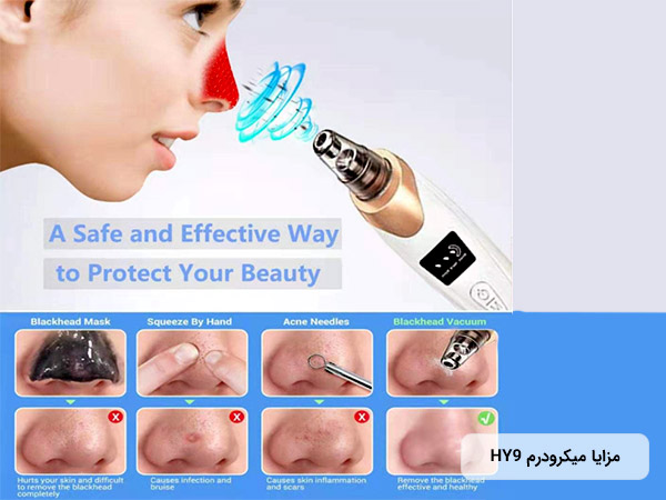 دستگاه میکرودرم خانگی HY9 با طراحی ارگونومیک