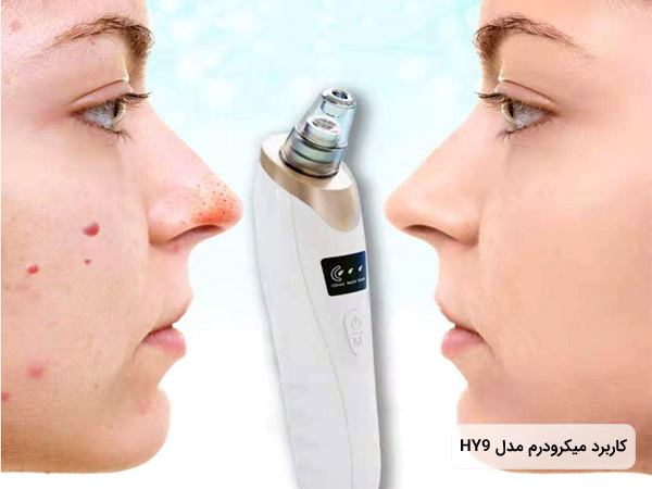 . دستگاه میکرودرم خانگی HY9 با طراحی ارگونومیک