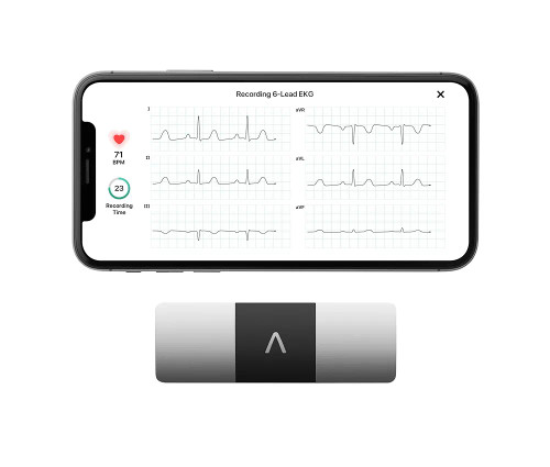 دستگاه نوار قلب قابل حمل AliveCor KardiaMobile 6L