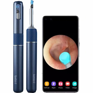 گوش پاک کن هوشمند تصویری بیبرد Bebird EarSight Plus با دوربین HD